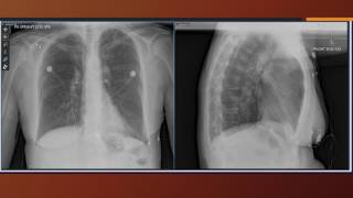 Cardiac case study