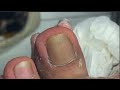 Clean the nail nail edge(plastic wrap is to keep skin wet for easier old skin removal)