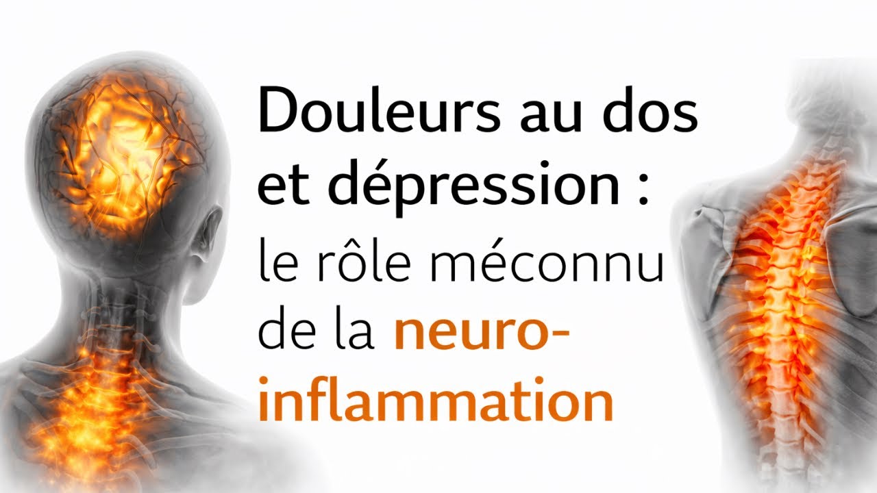Douleurs au dos et dépression : le rôle méconnu de la neuro-inflammation (capsule express)