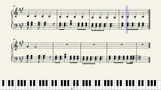 Miss You Oliver Tree Sheets And Midi