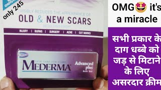 Medarma Cream Review and Demo / Best Cream for Scar / how to remove acne scar /acne scar treatment /