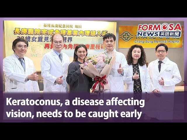 Keratoconus, a disease affecting vision, needs to be caught early｜Taiwan News