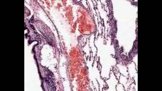 Shotgun Histology Lung