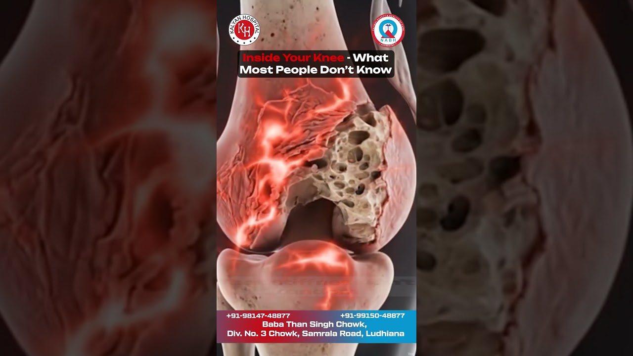Why Your Knee Feels Stiff Every Day | Best Orthopedic Doctor in Ludhiana