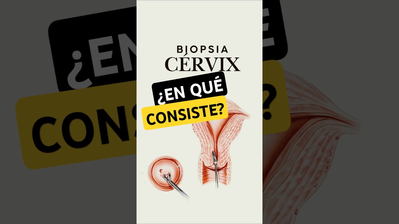 ¿Qué es una biopsia de cuello uterino? ¿EN qué consiste? #shorts