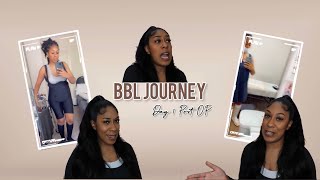 THE DAY AFTER BBL SX • POST OP DAY 1• SKINNY BBL DR. SISTO CHICAGO MIA AESTHETICS •  BODY REVEAL