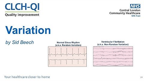 Bitesize QI - Variation