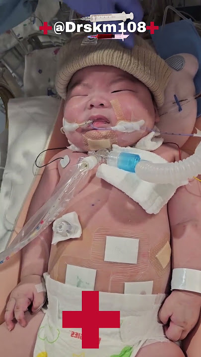 bayi baru lahir setelah lahir #menangis #motivasi #video viral #pekerjaan perawat#bayi lucu#Drskm108