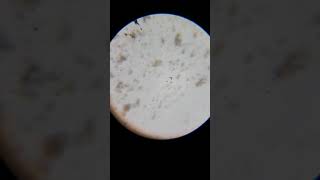 Bacteria VS Hand Sanitizer (Under Microscope) Wealth
