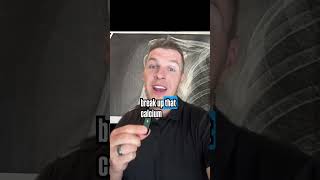 Calcium deposit SHATTERED with Shockwave Therapy 💥 #shouldderpainrelief #utahchiropractor