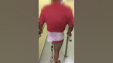 Hip Disarticulation Prostheses