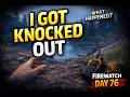 I Got Knocked Out… What Happened Next?! 😨 | Firewatch Day 76