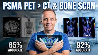 PSMA PET vs CT & Bone Scan: Which Is More Accurate?