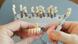 Teeth colors that dentures come in