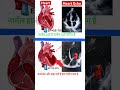 Normal heart Ef=55-70% &amp; Heart failure EF=25-30% Echo l #echo #shorts