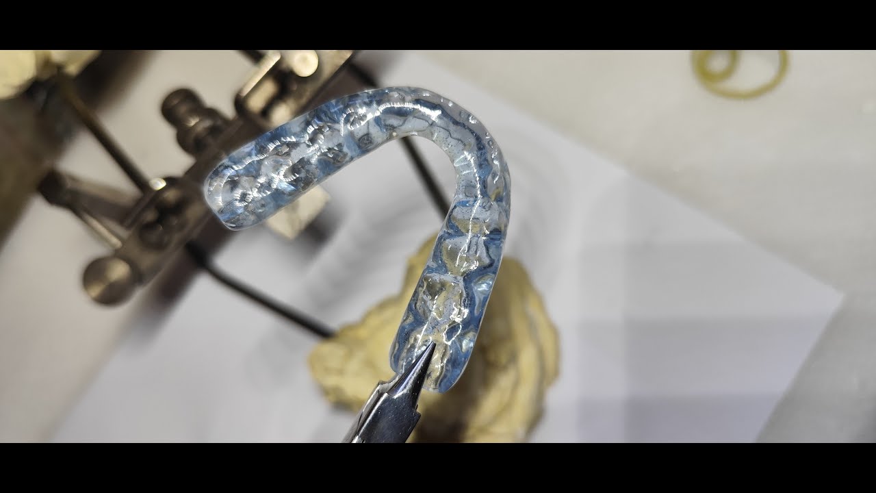 CONFECÇÃO DE PLACA PARA BRUXISMO INFERIOR - EM HD