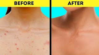 Brilliant hacks for the whole body! taking care of our body is an
essential part your beauty routine. since skin gets damaged just by
going through ou...