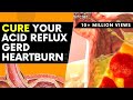 Cure Your Acid Reflux, GERD, Heartburn | treatment for acid reflux | cure your acid reflux at home