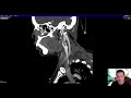 Vascular Imaging of the Head and Neck - Case B