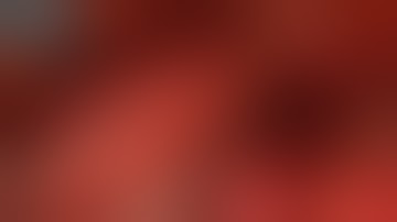 FULL LAPAROSCOPIC EXTENDED RIGHT HEPATECTOMY FOR LARGE HCC IN AN EXTREME CASE