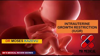 Intrauterine Growth restriction || IUGR