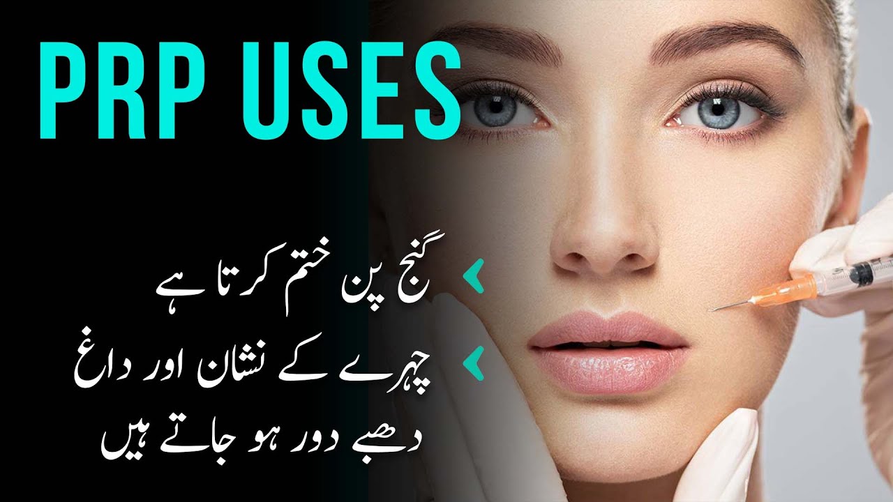 PRP treatment | PRP ke fayde | PRP kesy hoti ha | Dr. Haroon | eShaafi 