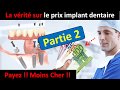 Prix implant dentaire   partie 2