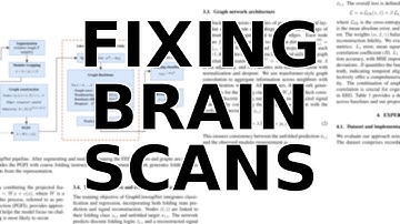 Unfolding Brainwaves: The AI That