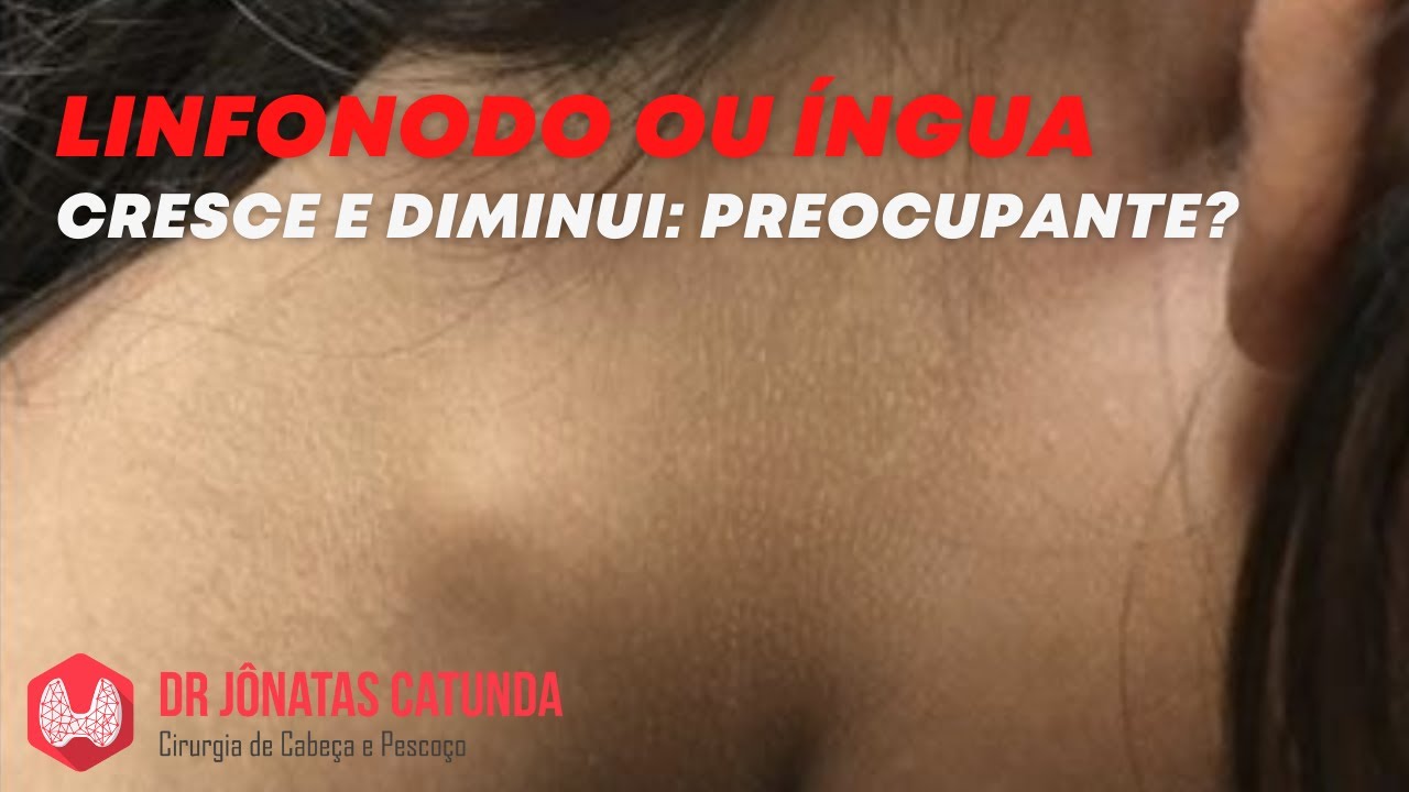 Linfonodo ou íngua no pescoço que cresce e diminui - É grave? - YouTube