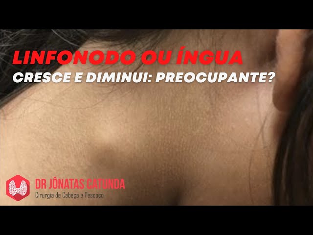 Diagrama De Ganglios Linfaticos Na Nuca