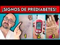 SIGNOS de PREDIABETES que SEGURO no CONOCIAS || ¿Cómo IDENTIFICAR una PREDIABETES?