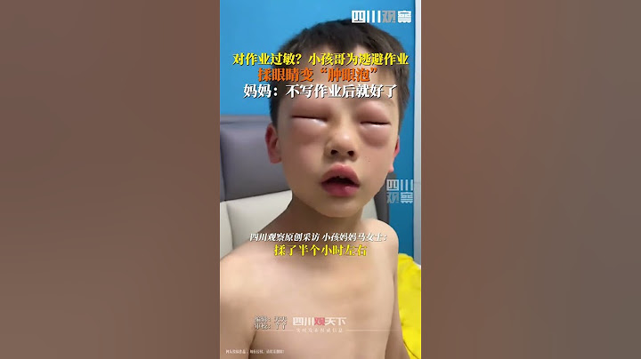 小孩哥為逃作業上演苦肉計，揉眼睛變“腫眼泡”，媽媽：不寫作業一會兒就緩解了！
