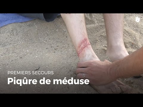 Vidéo: Comment reconnaître et traiter les raies et les oursins