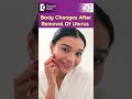 Body Changes After Removal Of Uterus| Osteoporosis - Dr.Shwetha Anand | Doctors&#39; Circle #shorts