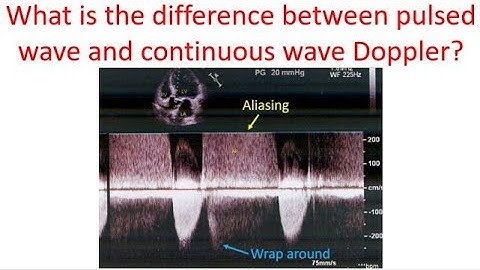 What is the difference between pulsed wave and continuous wave Doppler?