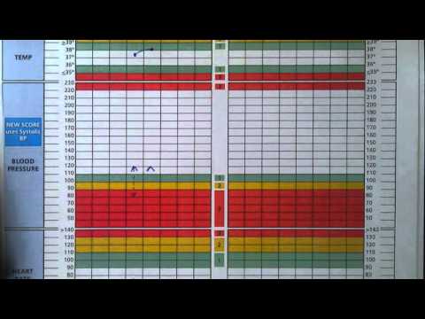 Ews Score Chart