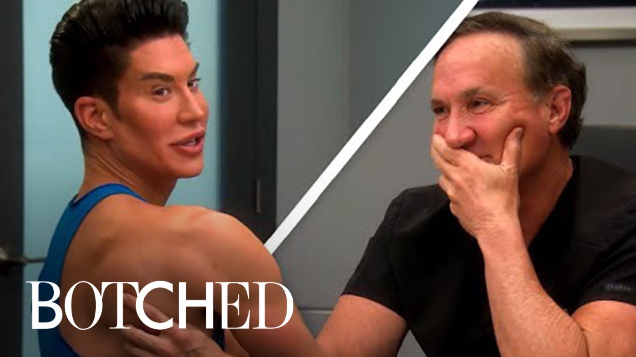 Botched' doctors Paul Nassif and Terry Dubrow talk Brazilian butt lifts and  the dangers of Instagram