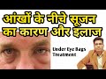 Aankhon Ke Neeche Swelling Ka Ilaj | आंखों के नीचे सूजन का इलाज | Aankhon Ke Neeche Sujan ka Upay..