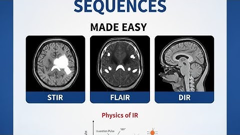 "Inversion Recovery Sequences in MRI | Simplified Explanation"#Abdullah sir #radiologymaster