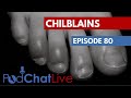 Podchatlive episode 80 with joseph frenkel on chilblains