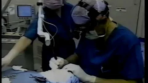Laser Resurfacing Bellevue - Dr. Fredric Stern Cos...