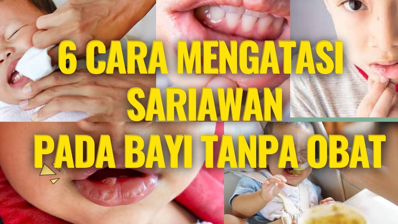 🔥 6 Cara Mengatasi Sariawan Pada Bayi Tanpa Obat - Cara Mudah Atasi