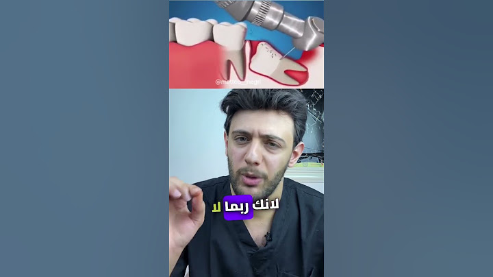 حل بالمنزل لو حصل معك نزيف بعد خلع الضرس #explore #doctor #تعلم #teeth