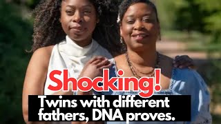Shocking: Twins with different fathers, DNA proves