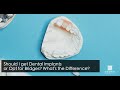 Should I Get Dental Implants vs Bridges? Wait for it...
