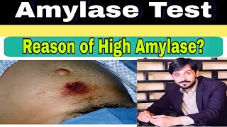 Amylase Test | Causes of High and Low Amylase in Blood