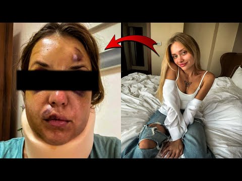 🔴 Ей сломали позвоночник и ноги | В каком состоянии Мария Ковальчук на данный момент?