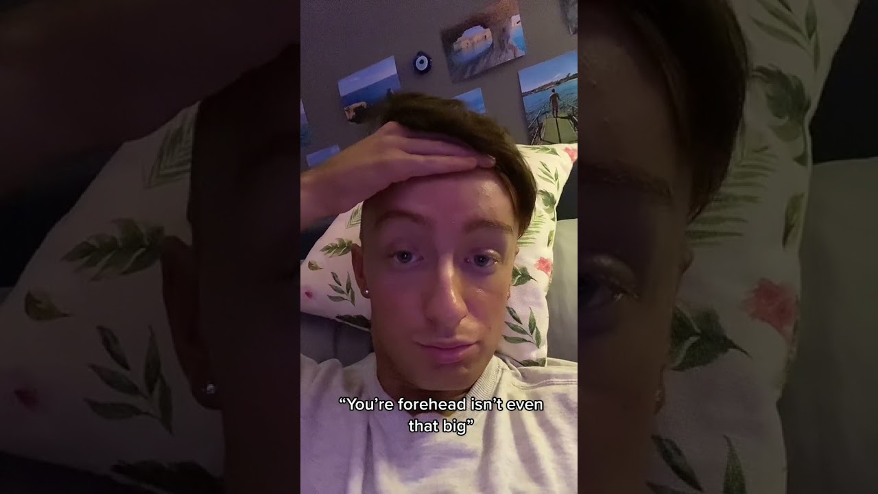 You're Forehead Isn't Even That Big harrylinford tiktok - YouTube