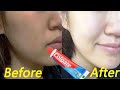 Apply Toothpaste on Your Skin & See Magical Result within 10 Minutes । Permanent Skin Whitening Pack