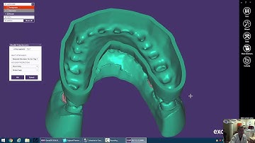 ExoCAD for 3D Printing: Hinge Articulator Options
